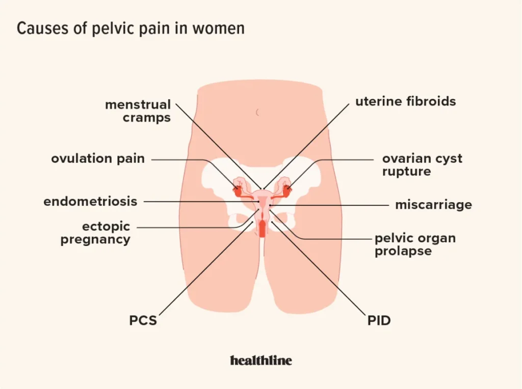 Why Do Women Have Pelvic Pain During Pregnancy?