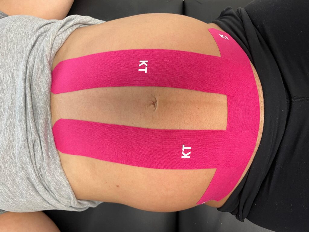 pregnancy belly tape