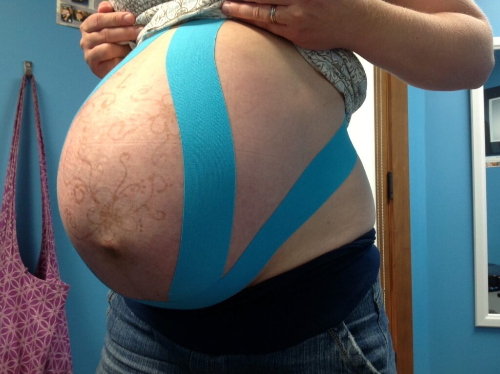 How to KT Tape Pregnant Belly