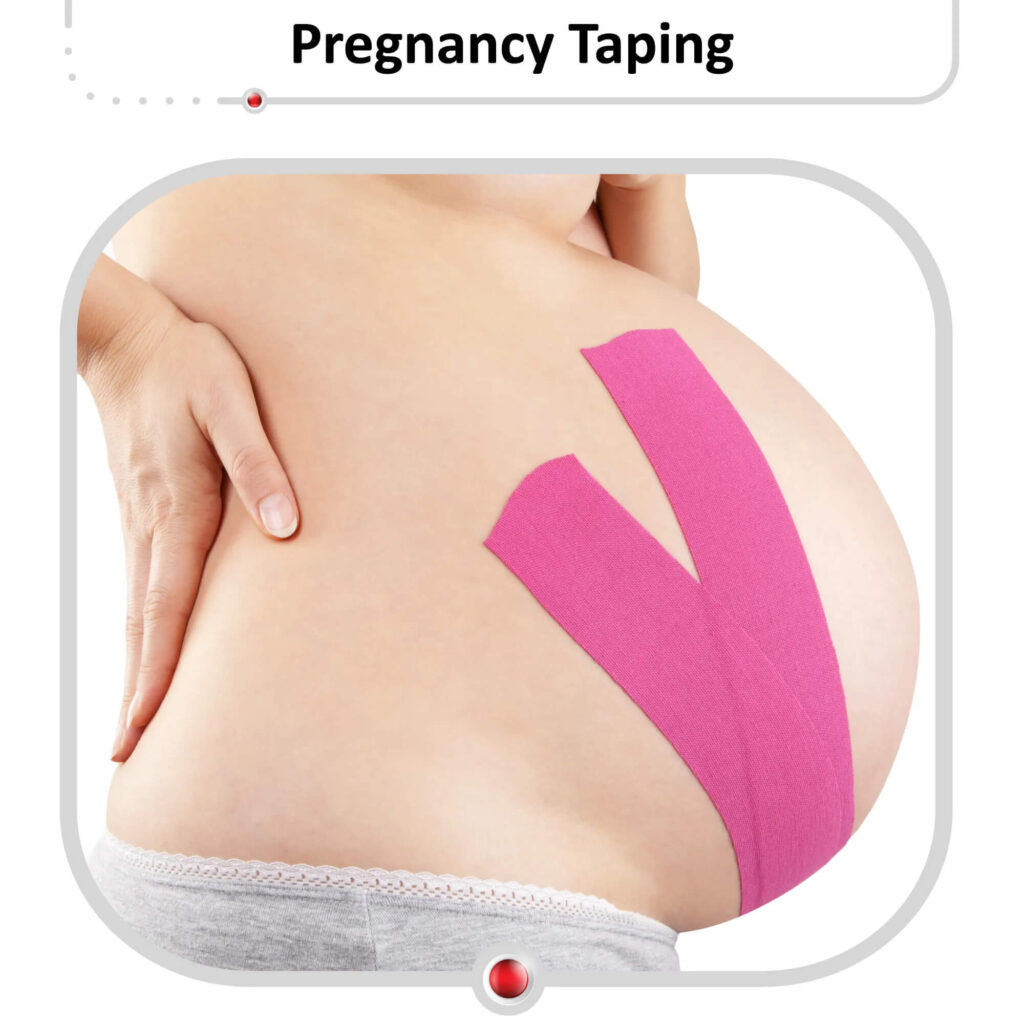 Is Pregnancy Tape Safe for Mothers